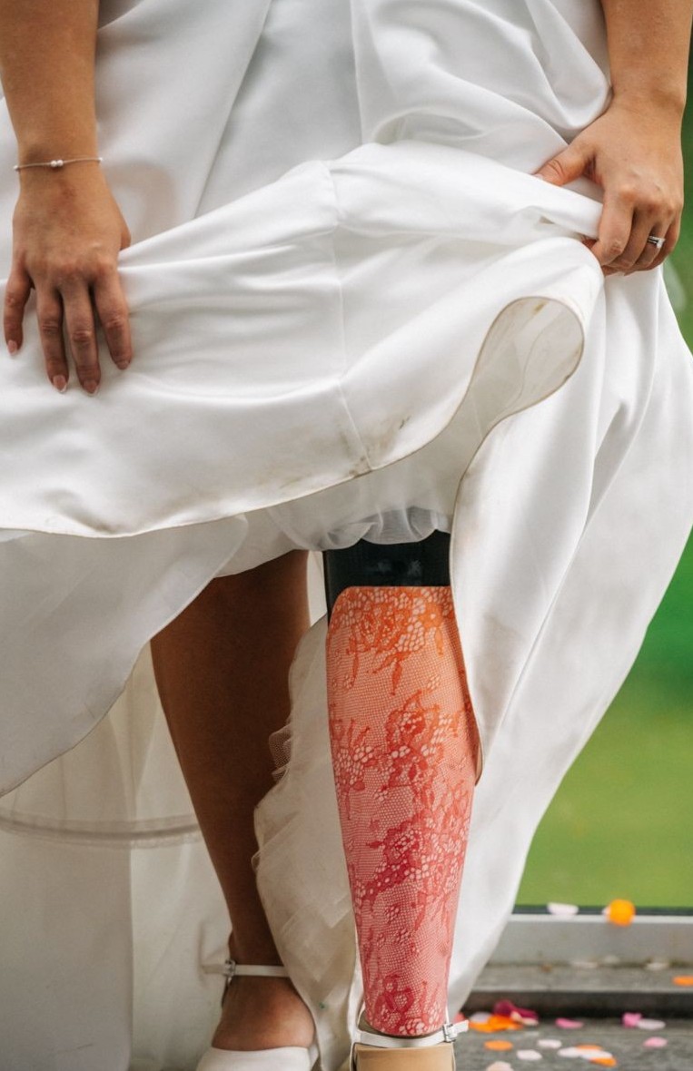 Prosthetic Limb Cover Art weding photo1