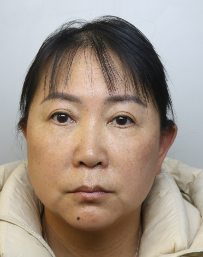 Liu Xu HOPKINS